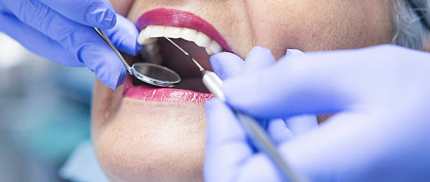 Best Broken or Chipped Tooth Repair in Heritage Village, CT